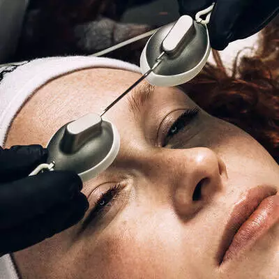 IPL Laser
