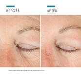 A.G.E. Advanced Eye mot mørke ringer